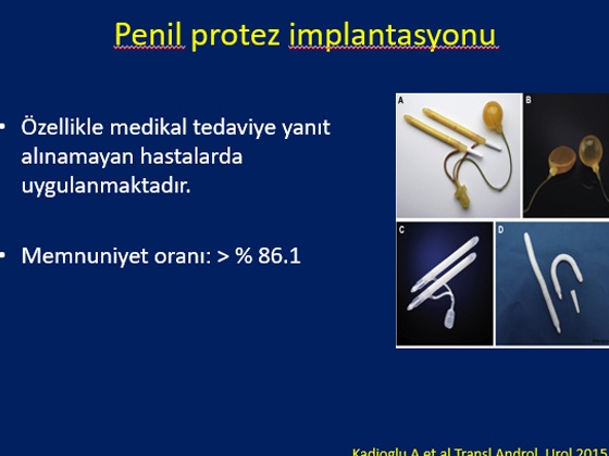 Radikal Prostatektomi Sonrası Erektil Disfonksiyon