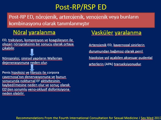 Radikal Prostatektomi Sonrası Erektil Disfonksiyon