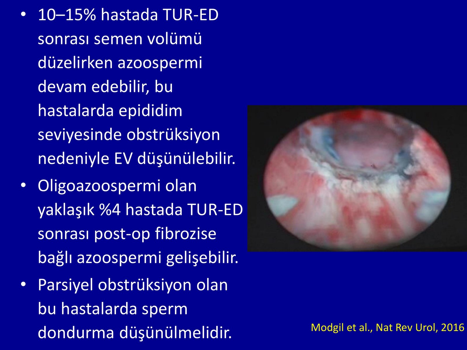 Erektil Disfonksiyon Tedavisi