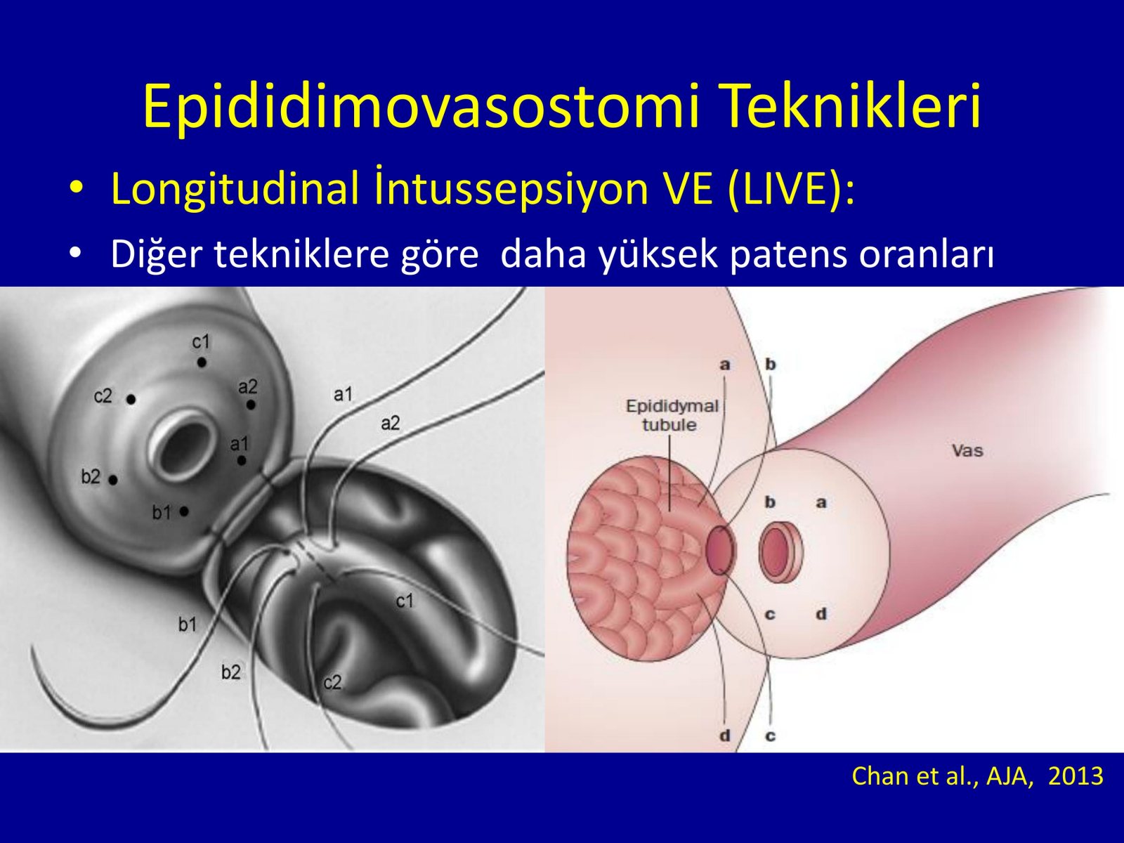 Erektil Disfonksiyon Tedavisi