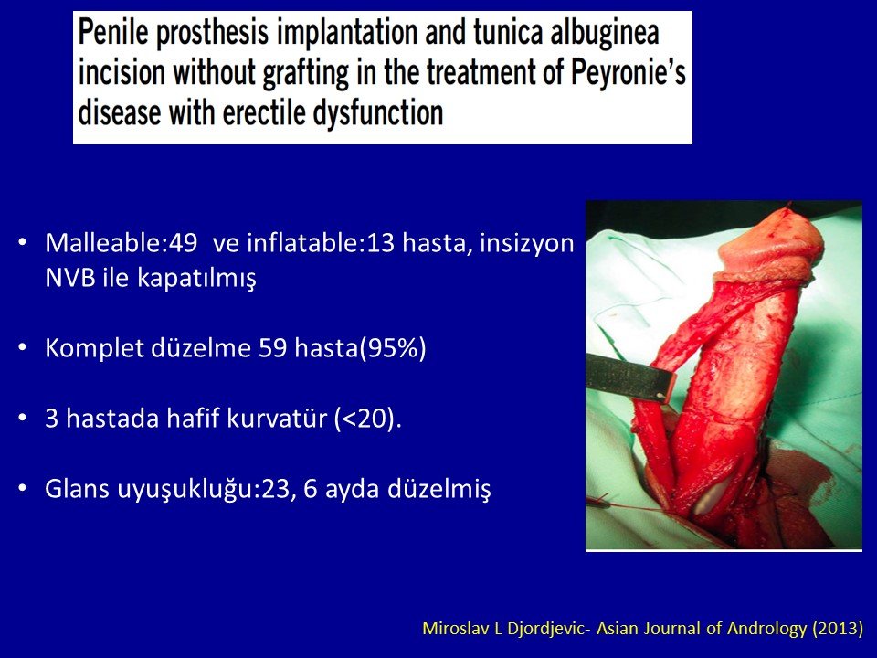 Peyronie Rekonstrüksiyon ve Penil Protez Teknikleri